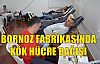 Bornoz Fabrikasında Kök Hücre Bağışı