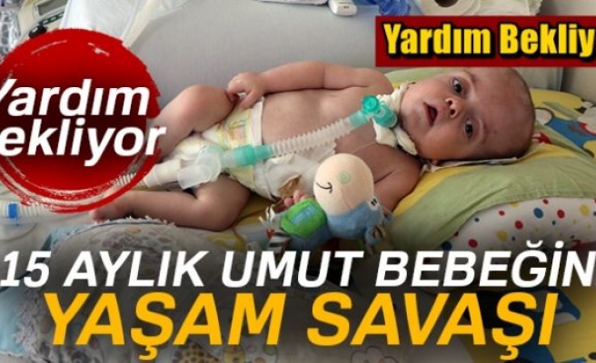 15 aylık Umut bebeğin yaşam mücadelesi