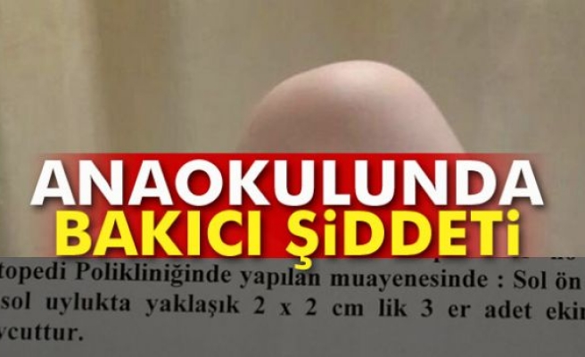 Anaokulunda Bakıcı Anne Şiddeti 