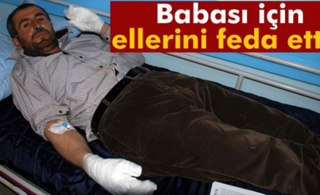 Babasını kurtarmak için ellerini feda etti