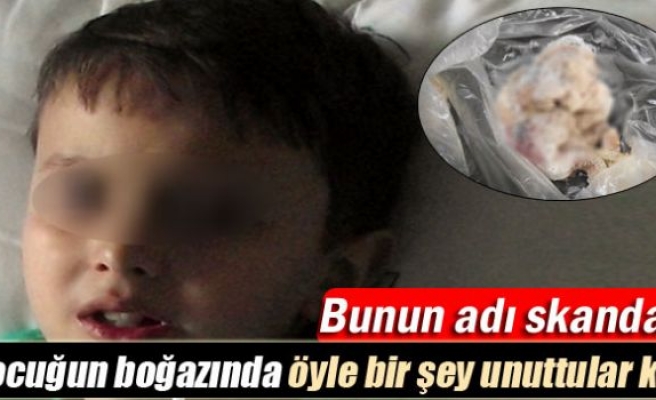 Boğazında gazlı bez unuttular!