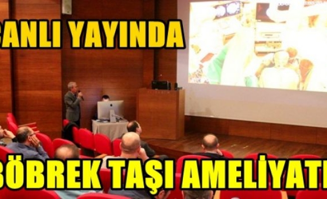 Canlı yayında böbrek taşı ameliyatı