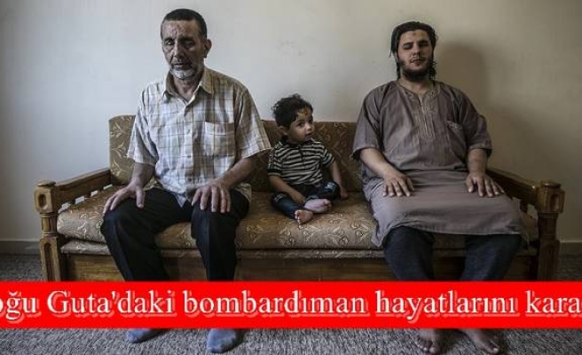 Doğu Guta'daki bombardıman hayatlarını kararttı