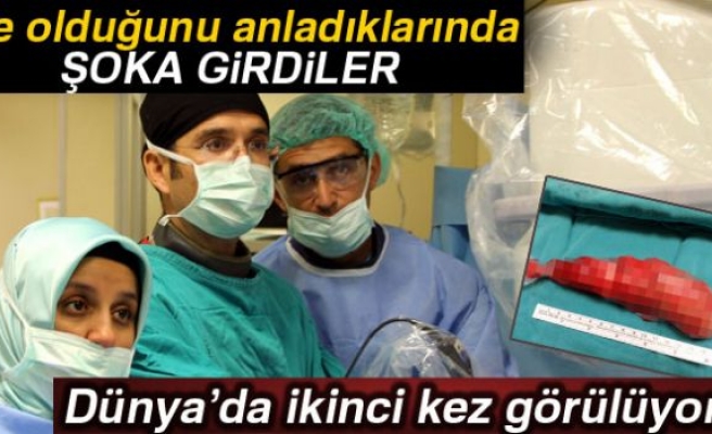 Dünyada ikinci kez Samsun'da rastlandı!