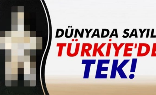 Dünyada sayılı Türkiye'de tek