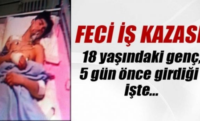 Elazığ'da feci iş kazası