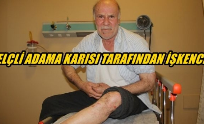 Felçli adama karısı tarafından işkence iddiası