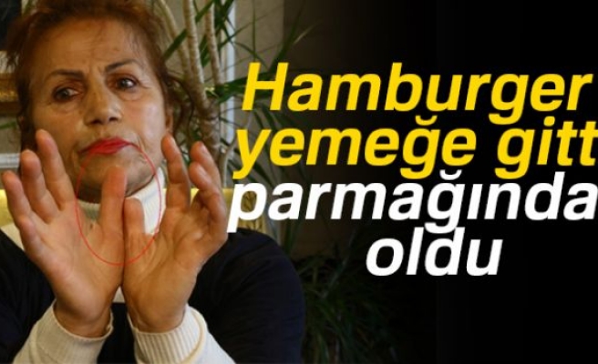 HAMBURGER YEMEĞE GİTTİ PARMAĞINDAN OLDU!