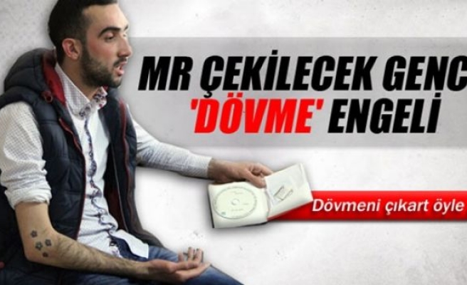 MR cekilecek gence 'dövme' engeli