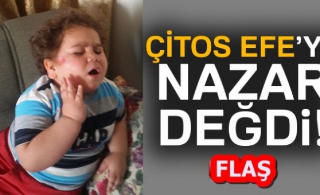 NAZAR DEĞDİ!