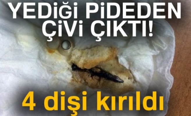 PİDEDEN ÇİVİ ÇIKTI!