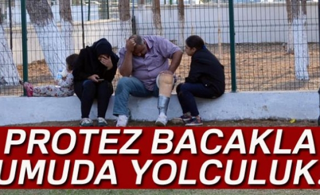 PROTEZ BACAKLA UMUDA YOLCULUK!