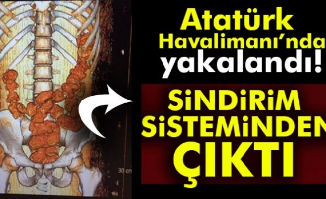 Sindirim sisteminden uyuşturucu çıktı