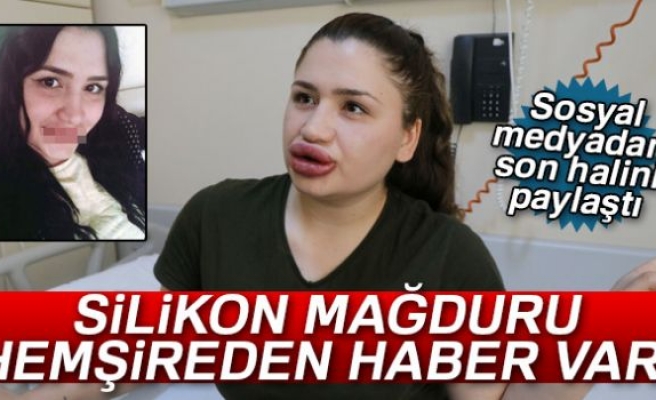 SLİKON MAĞDURU HEMŞİRENİN SON HALİ!