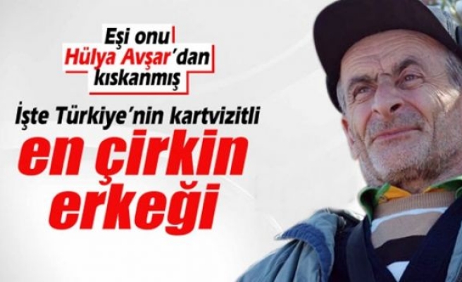 Türkiye’nin kartvizitli ‘en çirkin erkeği’