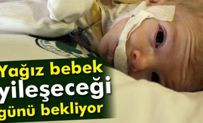 Yağız bebek iyileşeceği günü bekliyor