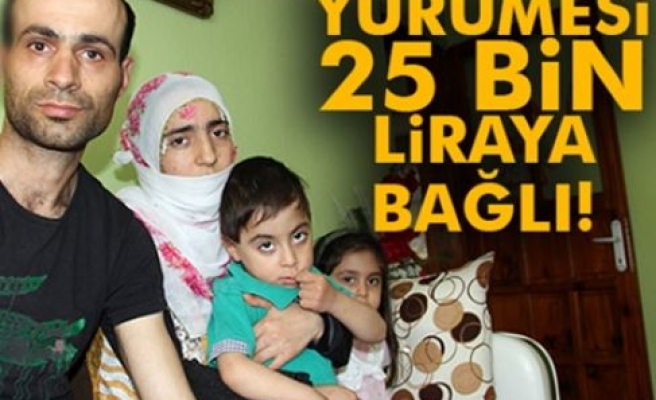 Yürümesi 25 Bin Liraya Bağlı