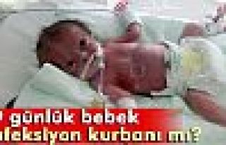 19 günlük ikizleri ölüm ayırdı