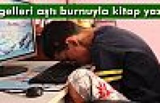 Engelleri aştı burnuyla kitap yazdı