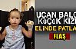 Gazlı uçan balon küçük kızın elini yaktı