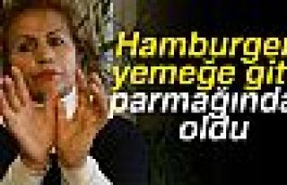 HAMBURGER YEMEĞE GİTTİ PARMAĞINDAN OLDU!